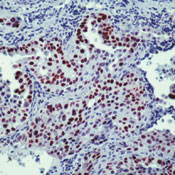     TTF-1 / TTF-1 (Thyroid Transcription Factor-1) Ab-1