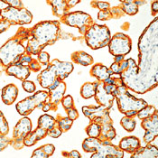        / Placental Alk. Phosphatase (PLAP) Ab-4