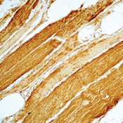     ,     /  Actin, Muscle Specific Ab-4 