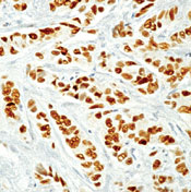       / Estrogen Receptor Ab-14