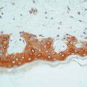      6 / Keratin 6 Ab-1