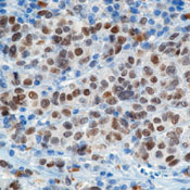      ( ) (MiTF)  / Microphthalmia (Transcription Factor) (MiTF) Ab-1 