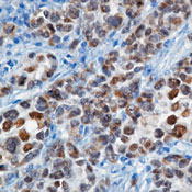      ( ) (MiTF)  / Microphthalmia (Transcription Factor) (MiTF) Ab-2 