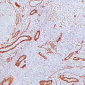      B2 / 1  / Laminin B2 / gamma1 Ab-1
