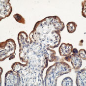       MMP-3 / MMP-3 (Stromelysin-1) Ab-2