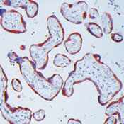      MMP-13 / MMP-13 (Collagenase-3) Ab-1  
