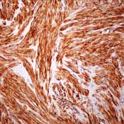       /  Actin, Smooth Muscle 