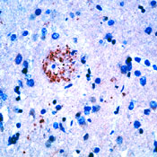     APP / Amyloid Precursor Protein (APP) 