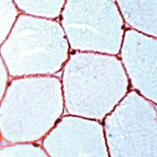       / Dystrophin  