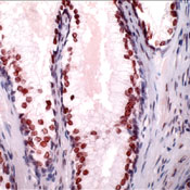       / Androgen Receptor.