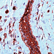         / Vascular Endothelial Growth Factor (VEGF).
