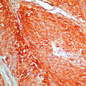      CD117/-kit / CD117 / c-Kit / SCF-Receptor.