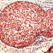         / Cathepsin D sample