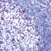       CD2  / CD2 sample