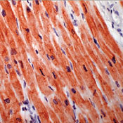      I  / Troponin I sample