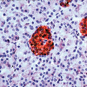      -  / Neuron Specific Enolase / NSE.