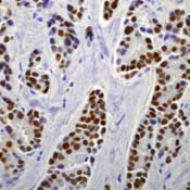       / Estrogen Receptor (SP1)
