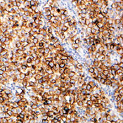        / Placental Alk. Phosphatase (PLAP) 