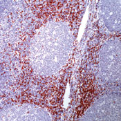    CD8 / CD8 (SP16)  