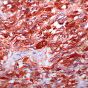      / Calcitonin (Rabbit Monoclonal)