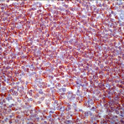    CD79 / CD79a / mb-1 (B-Cell Marker) (SP18)