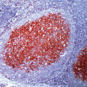     CD23 / CD23 (SP23)