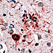       / Ubiquitin.