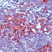      CITED1 / CITED1 (CBP/p300-interacting transactivator 1) / Melanocyte-specific protein 1