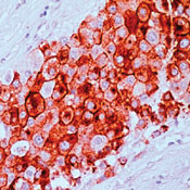      MUC-1 / MUC-1 (Epitope Specific Rabbit Antibody)