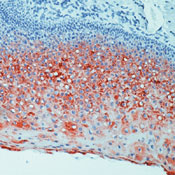      4  / Keratin 4 Ab-1 sample