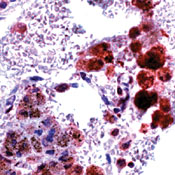      iNOS / Nitric Oxide Synthase, inducible (iNOS).