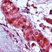        1   / Apoptosis Protease Activating Factor 1 (Apaf-1) sample