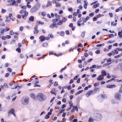     eNOS / Nitric Oxide Synthase, endothelial (eNOS).