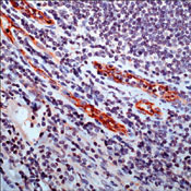       / CD105 / Endoglin / TGF beta 1/3 Receptor 