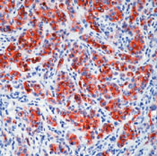        / Melanoma Marker, Pan Ab-1