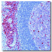     CD38 / CD38 Ab-3  