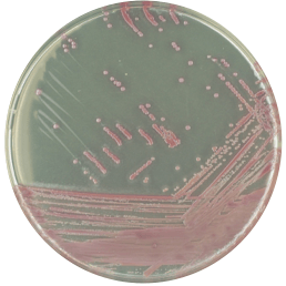 CHROMagar MRSA