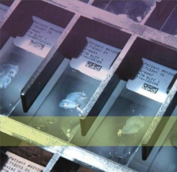     BCL-6 / BCL-6 1mL